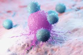 Pancreatic Cancer Metabolic Reprogramming